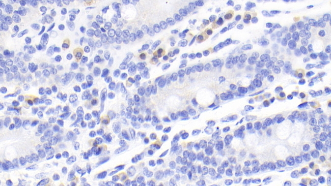 CTLA-4 Antibody in Immunohistochemistry (Paraffin) (IHC (P))