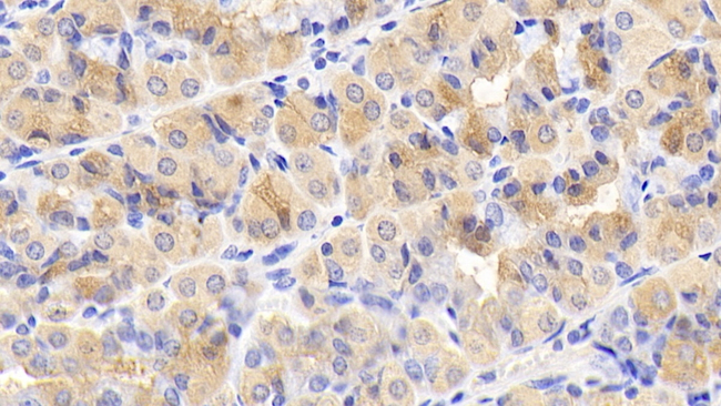 mTOR Antibody in Immunohistochemistry (Paraffin) (IHC (P))