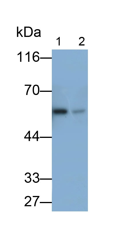 Catalase Antibody in Western Blot (WB)