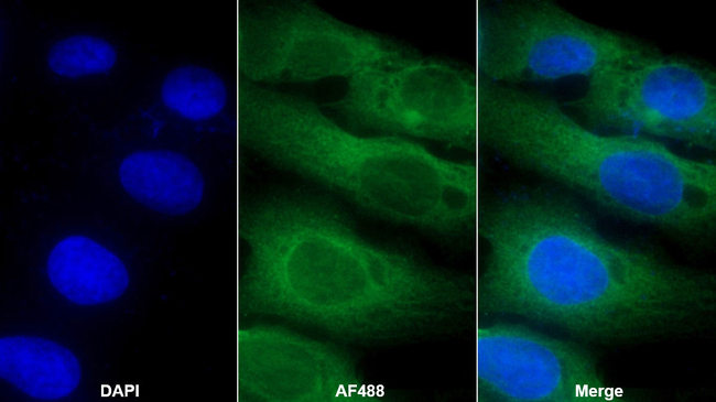 Somatostatin Antibody in Immunocytochemistry (ICC/IF)