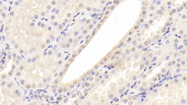 SERPINF2 Antibody in Immunohistochemistry (Paraffin) (IHC (P))