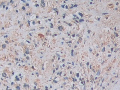 ADAM17 Antibody in Immunohistochemistry (Paraffin) (IHC (P))
