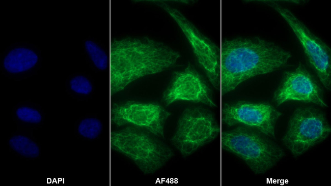 FABP1 Antibody in Immunocytochemistry (ICC/IF)
