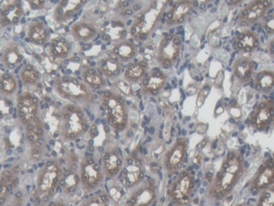 Ferritin Heavy Chain Antibody in Immunohistochemistry (Paraffin) (IHC (P))