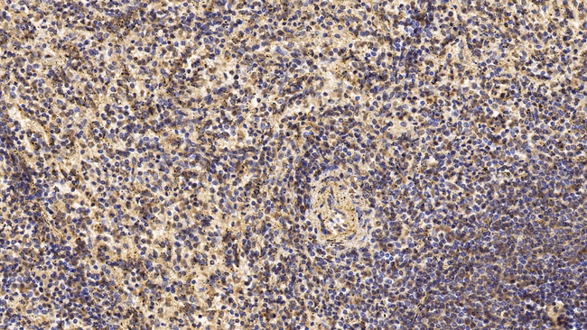 CD3 Antibody in Immunohistochemistry (Paraffin) (IHC (P))