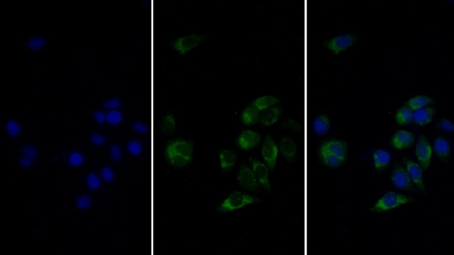 FABP3 Antibody in Immunocytochemistry (ICC/IF)