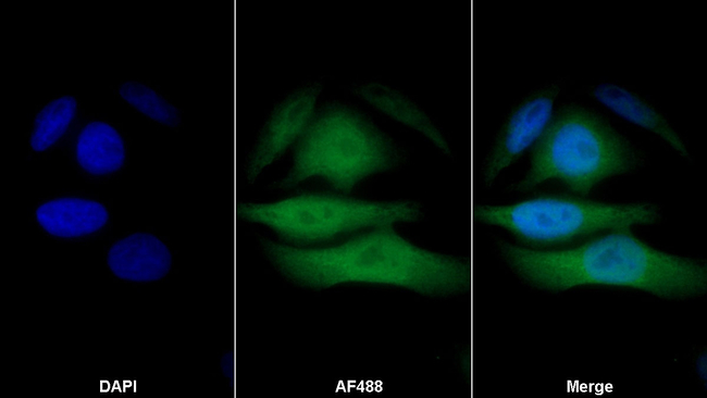 S100A1 Antibody in Immunocytochemistry (ICC/IF)