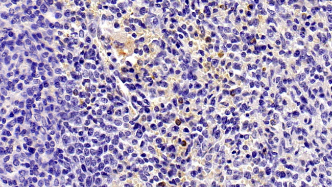IL8 Antibody in Immunohistochemistry (Paraffin) (IHC (P))