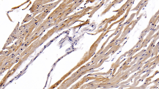 STAT3 Antibody in Immunohistochemistry (Paraffin) (IHC (P))