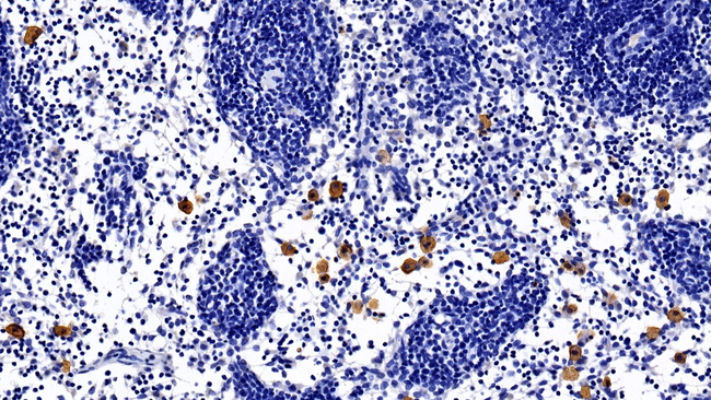 BST-1 Antibody in Immunohistochemistry (Paraffin) (IHC (P))
