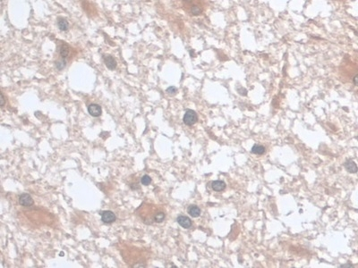 UCP2 Antibody in Immunohistochemistry (Paraffin) (IHC (P))