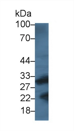 Cathepsin K Antibody in Western Blot (WB)