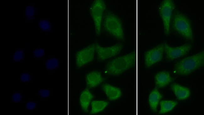 tPA Antibody in Immunocytochemistry (ICC/IF)