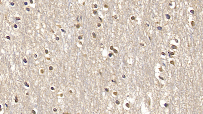 SMAD3 Antibody in Immunohistochemistry (Paraffin) (IHC (P))