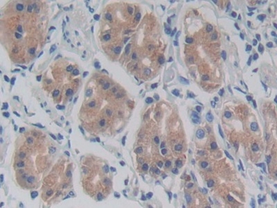 TLR5 Antibody in Immunohistochemistry (Paraffin) (IHC (P))