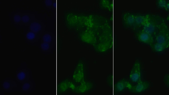 RIP1 Antibody in Immunocytochemistry (ICC/IF)
