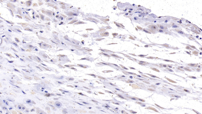 Desmoglein 3 Antibody in Immunohistochemistry (Paraffin) (IHC (P))