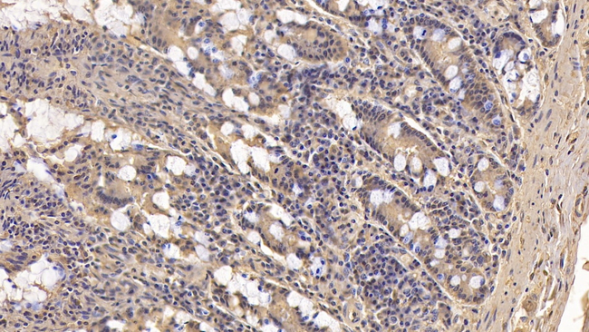 FAP Antibody in Immunohistochemistry (Paraffin) (IHC (P))