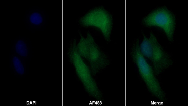 Cofilin Antibody in Immunocytochemistry (ICC/IF)