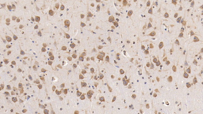 RAB5A Antibody in Immunohistochemistry (Paraffin) (IHC (P))