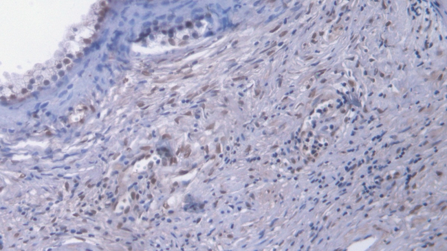 EGR1 Antibody in Immunohistochemistry (Paraffin) (IHC (P))