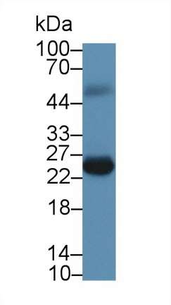 FKBP7 Antibody in Western Blot (WB)