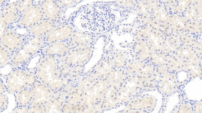 RHD Antibody in Immunohistochemistry (Paraffin) (IHC (P))