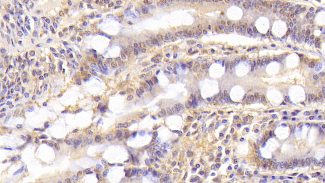 Syntenin 2 Antibody in Immunohistochemistry (Paraffin) (IHC (P))