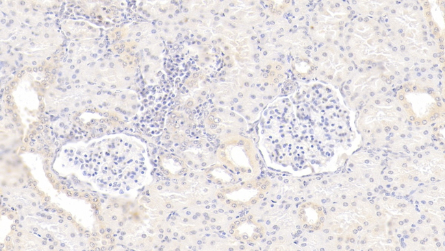 GREM1 Antibody in Immunohistochemistry (Paraffin) (IHC (P))