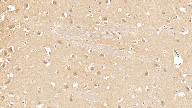 CK1 delta Antibody in Immunohistochemistry (Paraffin) (IHC (P))