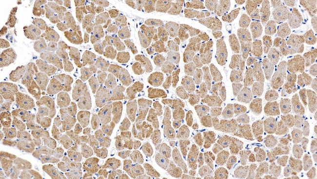 IL-6 Antibody in Immunohistochemistry (Paraffin) (IHC (P))