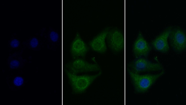 C1S Antibody in Immunocytochemistry (ICC/IF)