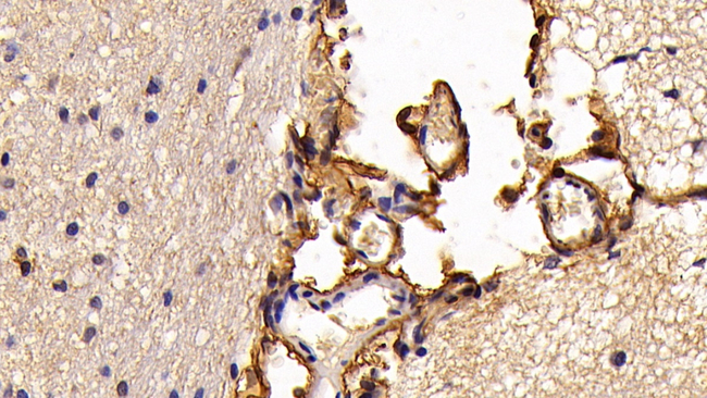 S100A10 Antibody in Immunohistochemistry (Paraffin) (IHC (P))