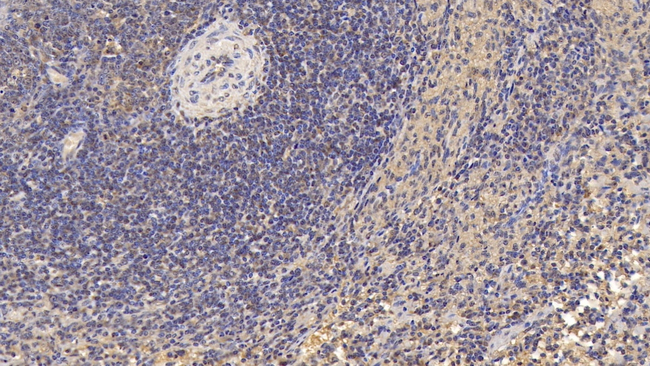 CD3d Antibody in Immunohistochemistry (Paraffin) (IHC (P))
