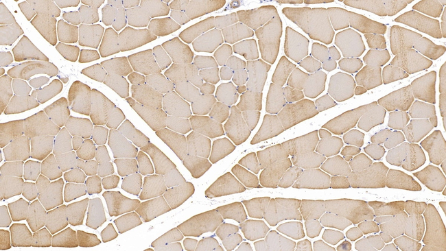 alpha-Cardiac Actin Antibody in Immunohistochemistry (Paraffin) (IHC (P))