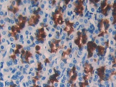 Cystatin B Antibody in Immunohistochemistry (Paraffin) (IHC (P))