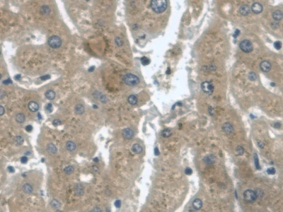TGF alpha Chimeric Antibody in Immunohistochemistry (Paraffin) (IHC (P))