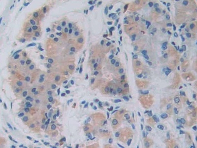 GHRH Antibody in Immunohistochemistry (Paraffin) (IHC (P))