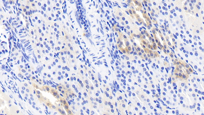 beta L Crystallin Antibody in Immunohistochemistry (Paraffin) (IHC (P))