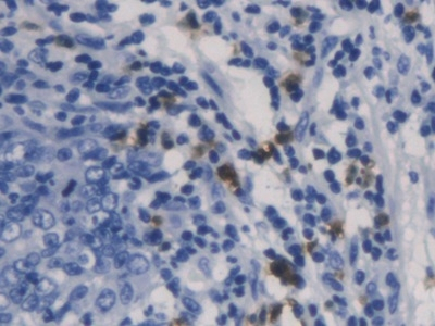 Galectin 10 Antibody in Immunohistochemistry (Paraffin) (IHC (P))