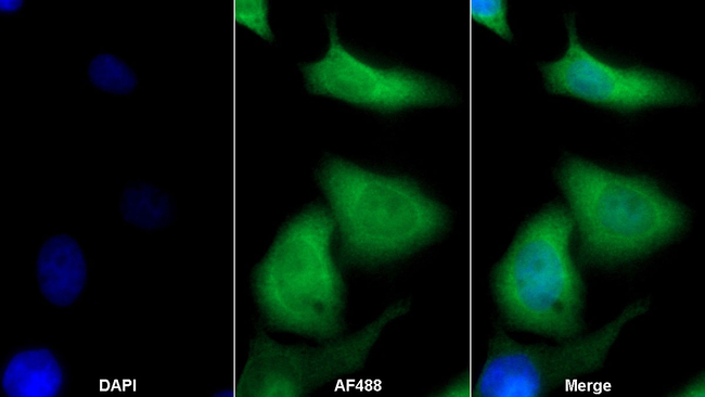 S100P Antibody in Immunocytochemistry (ICC/IF)