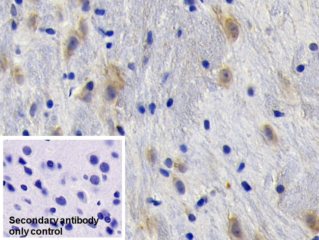 NGF Antibody in Immunohistochemistry (Paraffin) (IHC (P))