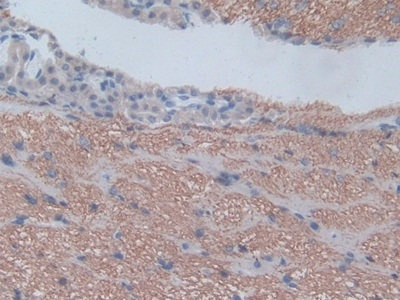 CXCL1 Antibody in Immunohistochemistry (Paraffin) (IHC (P))