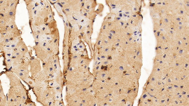 FGF1 Antibody in Immunohistochemistry (Paraffin) (IHC (P))