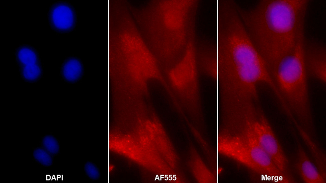 ALPL Antibody in Immunocytochemistry (ICC/IF)