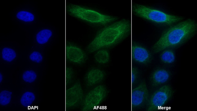 MMP13 Antibody in Immunocytochemistry (ICC/IF)