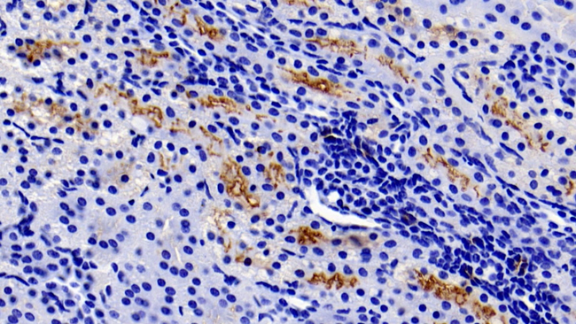 GGT1 Antibody in Immunohistochemistry (Paraffin) (IHC (P))