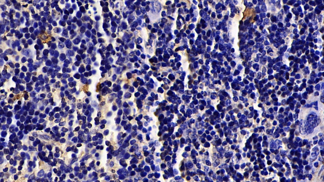 Granzyme K Antibody in Immunohistochemistry (Paraffin) (IHC (P))