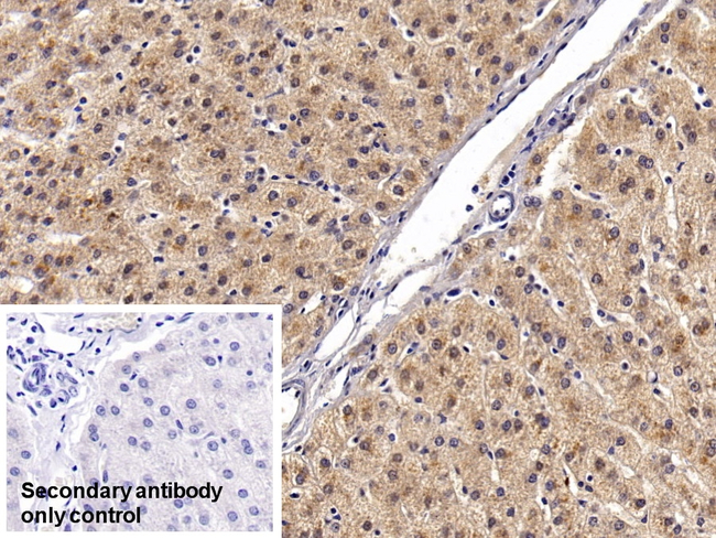 Angiostatin Antibody in Immunohistochemistry (Paraffin) (IHC (P))