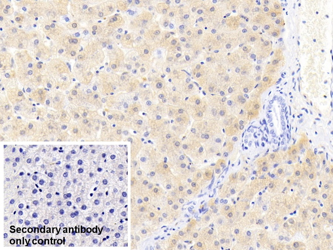 Ferritin Light Chain Antibody in Immunohistochemistry (Paraffin) (IHC (P))